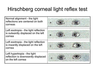 Pediatric Vision screening for General Practioner and family physician.pptx