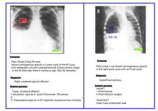 Comprehensive Pediatric Radiology: Chest and Cardiac X-Ray ...