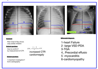 Comprehensive Pediatric Radiology: Chest and Cardiac X-Ray ...