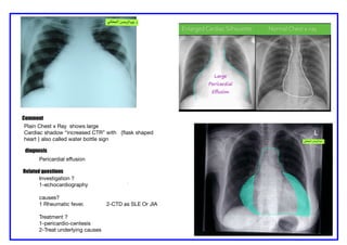 Comprehensive Pediatric Radiology: Chest and Cardiac X-Ray ...