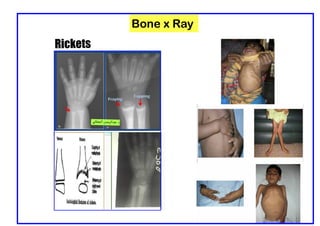Xbone Ray Comprehensive Pediatric Radiology: Chest and Cardiac X-Ray ...