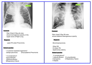 Heterogeneous Opacity Comprehensive Pediatric Radiology: Chest and Cardiac X-Ray ...