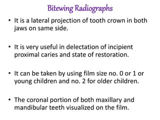 Bitewing Radiographs
• It is a lateral projection of tooth crown in both
jaws on same side.
• It is very useful in delectation of incipient
proximal caries and state of restoration.
• It can be taken by using film size no. 0 or 1 or
young children and no. 2 for older children.
• The coronal portion of both maxillary and
mandibular teeth visualized on the film.
 