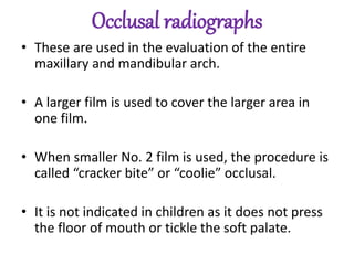 Occlusal radiographs
• These are used in the evaluation of the entire
maxillary and mandibular arch.
• A larger film is used to cover the larger area in
one film.
• When smaller No. 2 film is used, the procedure is
called “cracker bite” or “coolie” occlusal.
• It is not indicated in children as it does not press
the floor of mouth or tickle the soft palate.
 
