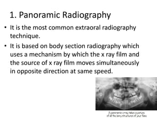 1. Panoramic Radiography
• It is the most common extraoral radiography
technique.
• It is based on body section radiography which
uses a mechanism by which the x ray film and
the source of x ray film moves simultaneously
in opposite direction at same speed.
 