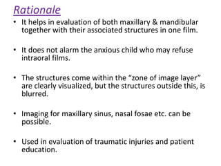 Rationale
• It helps in evaluation of both maxillary & mandibular
together with their associated structures in one film.
• It does not alarm the anxious child who may refuse
intraoral films.
• The structures come within the “zone of image layer”
are clearly visualized, but the structures outside this, is
blurred.
• Imaging for maxillary sinus, nasal fosae etc. can be
possible.
• Used in evaluation of traumatic injuries and patient
education.
 