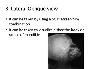 3. Lateral Oblique view
• It can be taken by using a 5X7” screen film
combination.
• It can be taken to visualize either the body or
ramus of mandible.
 