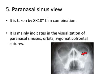 5. Paranasal sinus view
• It is taken by 8X10” film combination.
• It is mainly indicates in the visualization of
paranasal sinuses, orbits, zygomaticofrontal
sutures.
 