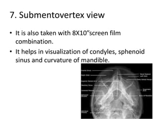 7. Submentovertex view
• It is also taken with 8X10”screen film
combination.
• It helps in visualization of condyles, sphenoid
sinus and curvature of mandible.
 