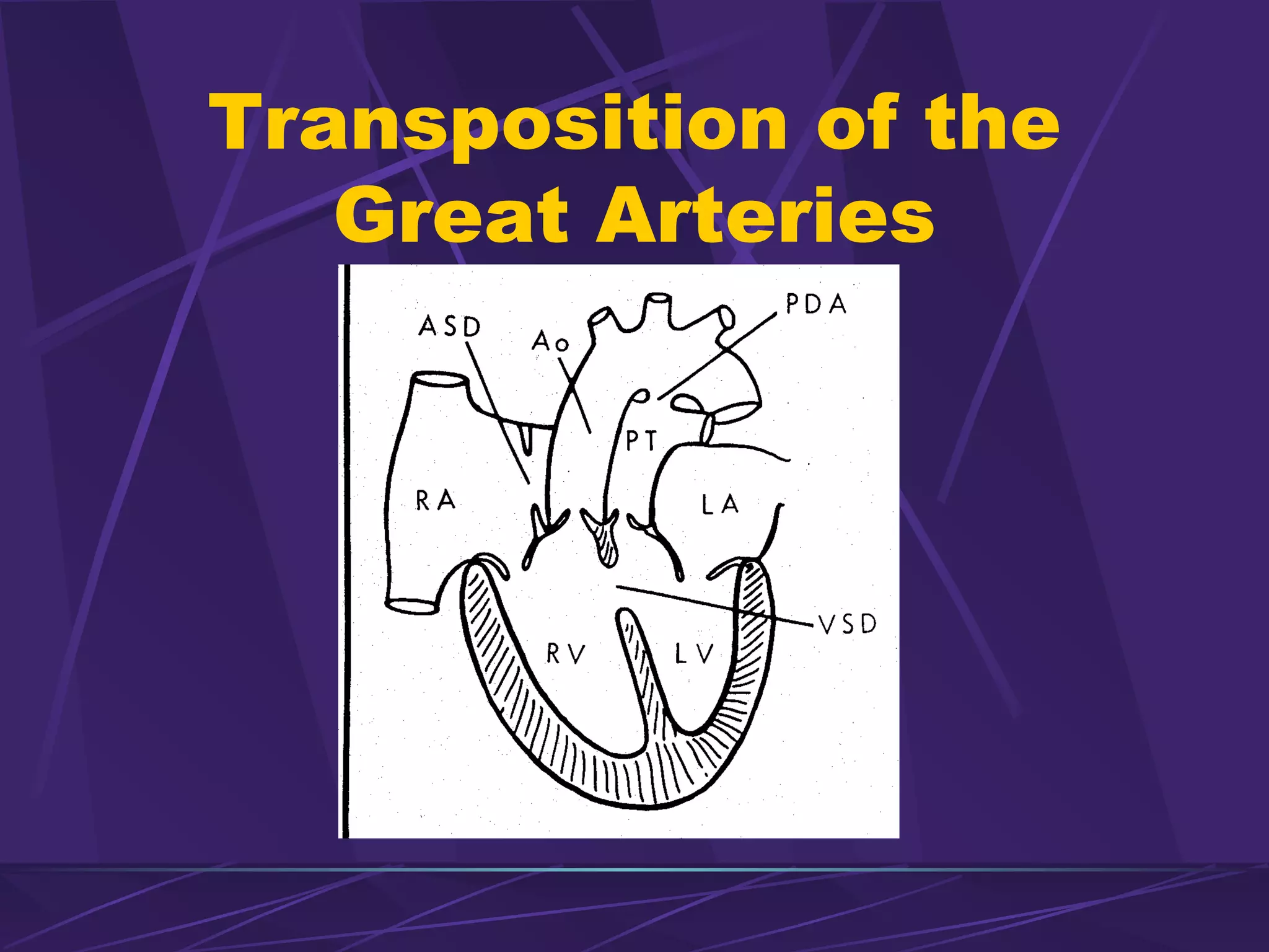 Pediatric Cardiology Emergencies Ppt Pediatric Cardiology Emergencies Ppt