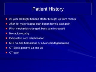 Patient History
25 year old Right handed starter brought up from minors
After 1st major league start began having back pain
Pitch mechanics changed, back pain increased
No radiculopathy
Exhaustive core rehabilitation
MRI no disc herniations or advanced degeneration
CT Spect positive L3 and L5
CT scan
 