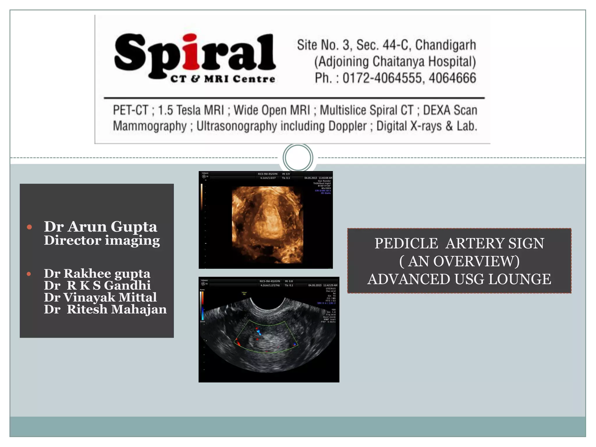 Pedicle artery sign | PPTX
