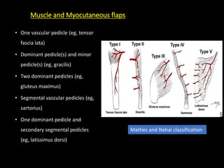 Pedicle Flaps Example Pedicle flap in Maxillofacial Surgery | PPTX