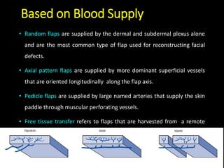 Pedicle Flaps Example Pedicle flap in Maxillofacial Surgery | PPTX