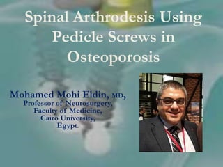Spinal Arthrodesis Using
Pedicle Screws in
Osteoporosis
Mohamed Mohi Eldin, MD,
Professor of Neurosurgery,
Faculty of Medicine,
Cairo University,
Egypt.
 
