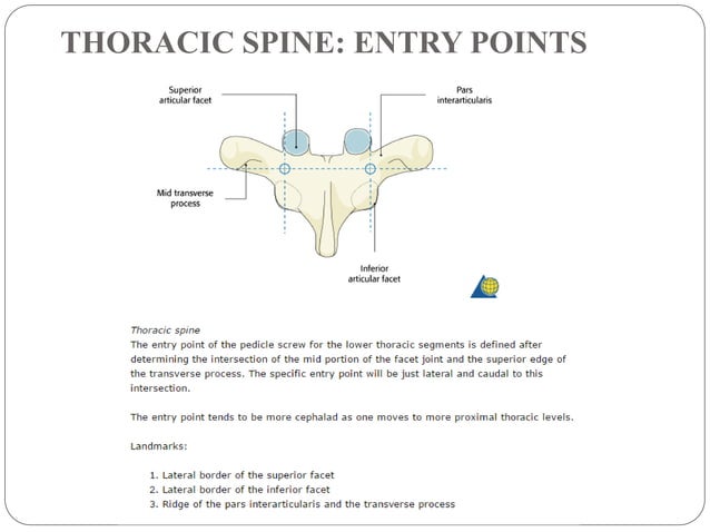 pedicle-screws-fixation-of-thoraco-lumbar-spine-pptx-death-injury