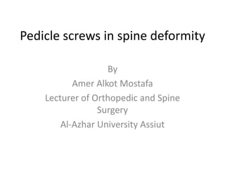 Pedicle screws in spine deformity
By
Amer Alkot Mostafa
Lecturer of Orthopedic and Spine
Surgery
Al-Azhar University Assiut
 