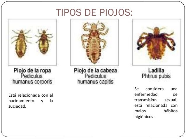 Los aceites para los cabellos de la jojoba de almendra