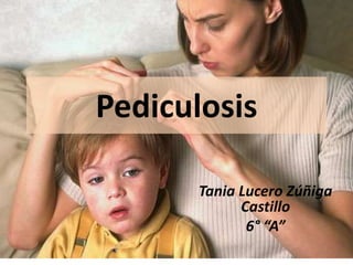 Pediculosis
Tania Lucero Zúñiga
Castillo
6° “A”
 