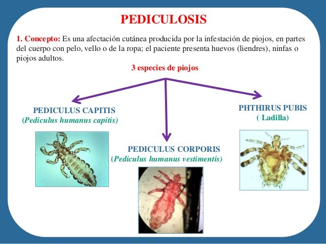 Pediculosis and Pthiriasis (Lice Infestation): Background ...