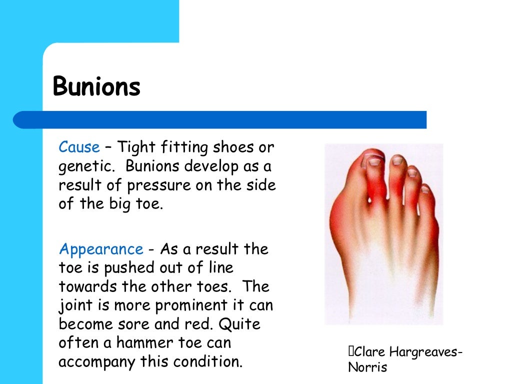 Pedicure contraindications