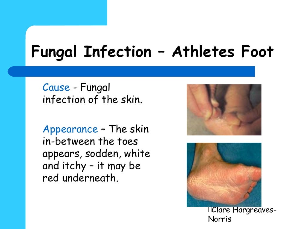 Pedicure contraindications