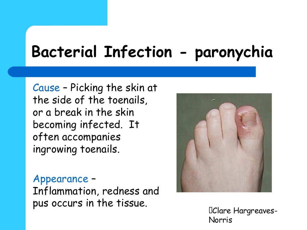 Pedicure contraindications