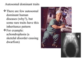 Autosomal dominant traits
There are few autosomal
dominant human
diseases (why?), but
some rare traits have this
inheritance pattern
For example:
achondroplasia (a
sketelal disorder causing
dwarfism)
 