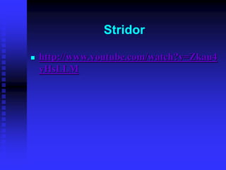 Stridor
 http://www.youtube.com/watch?v=Zkau4
yHsLLM
 