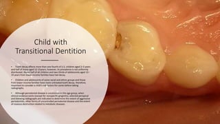 Transitional Teeth Guidelines for dental radiographs for pediatric and adolescent | PPTX