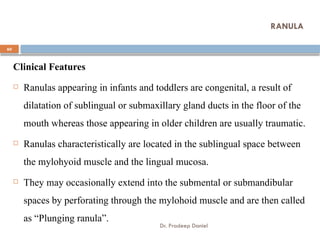 Pediatric Ranula Pediatric minor oral surgery part 1 &2.pdf