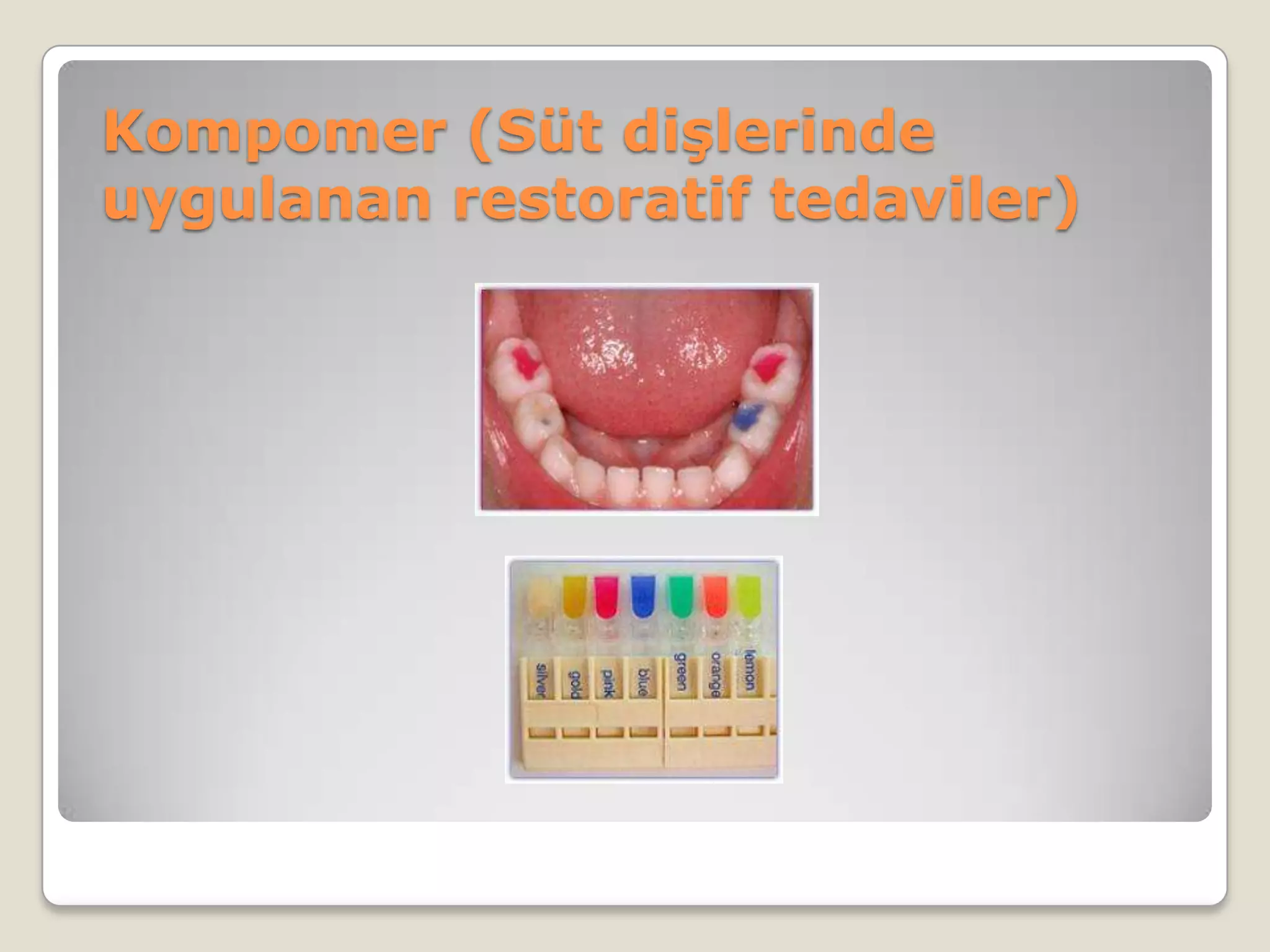 Kompomer (Süt dişlerinde
uygulanan restoratif tedaviler)
 
