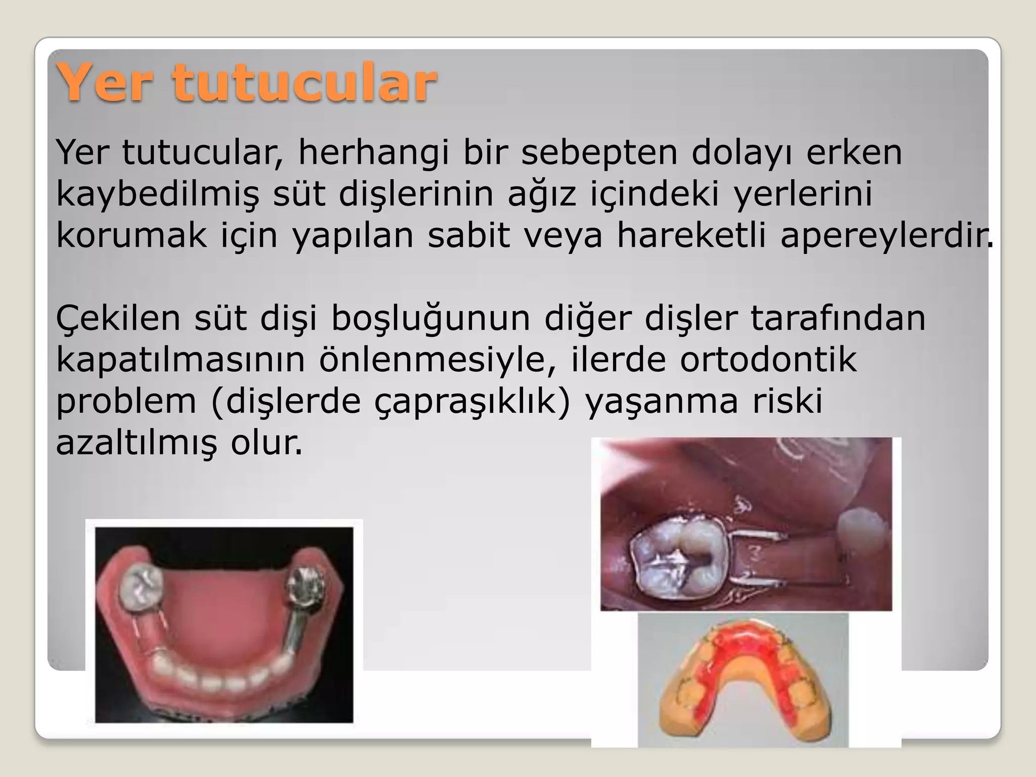 Yer tutucular
Yer tutucular, herhangi bir sebepten dolayı erken
kaybedilmiş süt dişlerinin ağız içindeki yerlerini
korumak için yapılan sabit veya hareketli apereylerdir.
Çekilen süt dişi boşluğunun diğer dişler tarafından
kapatılmasının önlenmesiyle, ilerde ortodontik
problem (dişlerde çapraşıklık) yaşanma riski
azaltılmış olur.
 