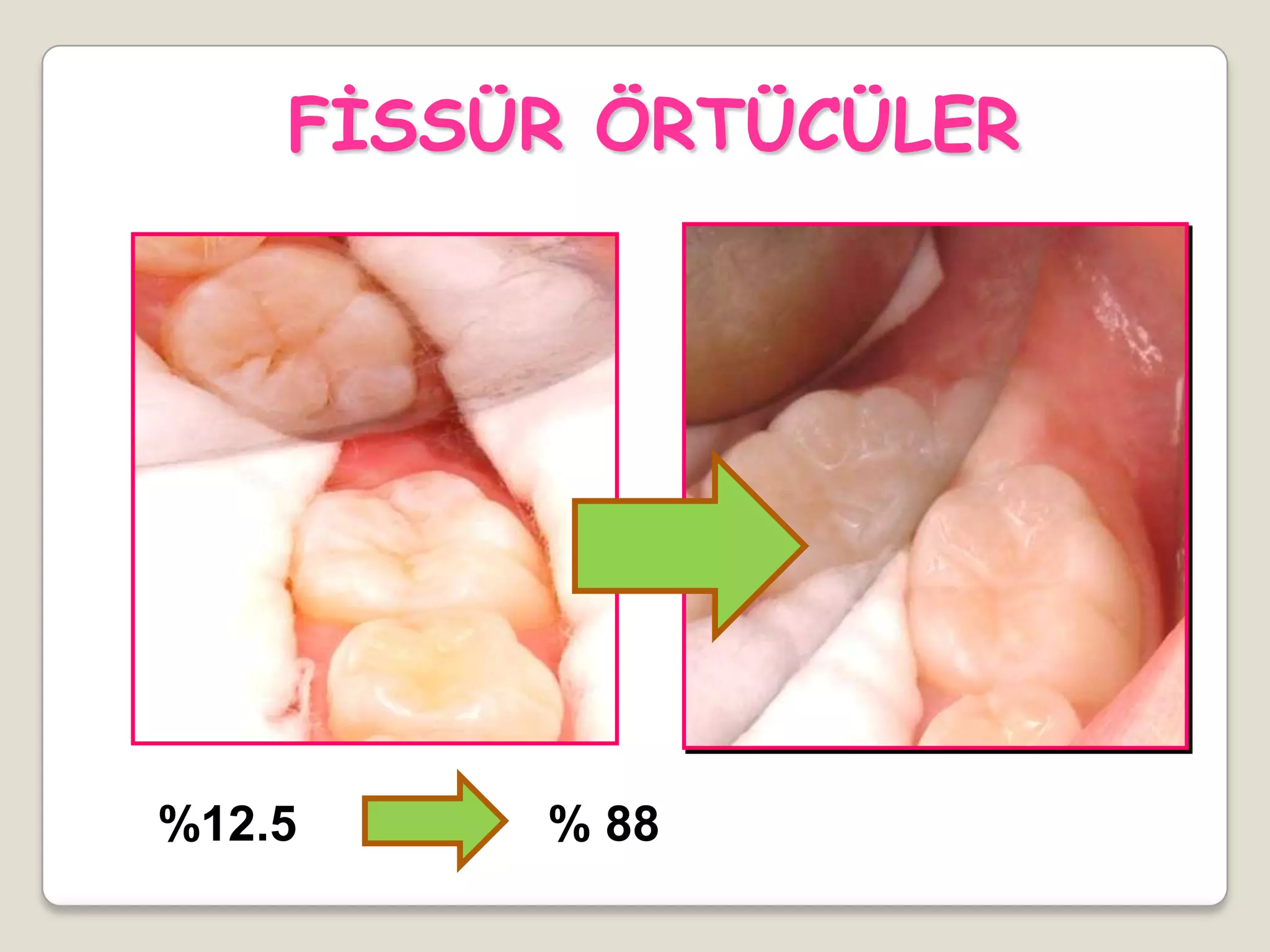 FĠSSÜR ÖRTÜCÜLER
%12.5 % 88
 