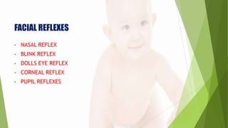 FACIAL REFLEXES
• NASAL REFLEX
• BLINK REFLEX
• DOLLS EYE REFLEX
• CORNEAL REFLEX
• PUPIL REFLEXES
 
