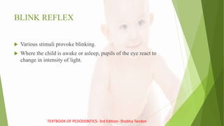 BLINK REFLEX
 Various stimuli provoke blinking.
 Where the child is awake or asleep, pupils of the eye react to
change in intensity of light.
TEXTBOOK OF PEDODONTICS- 3rd Edition- Shobha Tandon
 