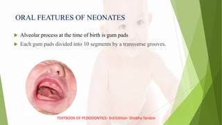 ORAL FEATURES OF NEONATES
 Alveolar process at the time of birth is gum pads
 Each gum pads divided into 10 segments by a transverse grooves.
TEXTBOOK OF PEDODONTICS- 3rd Edition- Shobha Tandon
 