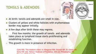 TONSILS & ADENOIDS
 At birth: tonsils and adenoids are small in size.
 Clusters of yellow and white follicles with erythematous
border may appear initially.
 A few days after birth these may regress.
 First few months: the growth of tonsils and adenoids
takes place as lymphoid tissue starts proliferating and
establishing function.
 This growth is more in presence of infection.
Carlo WA. The newborn infant. In: Kliegman RM, Stanton BF, St. Geme JW,
Schor NF, eds. Nelson Textbook of Pediatrics. 20th ed. Philadelphia, PA:
 