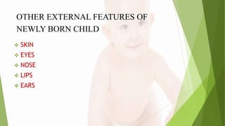OTHER EXTERNAL FEATURES OF
NEWLY BORN CHILD
 SKIN
 EYES
 NOSE
 LIPS
 EARS
 