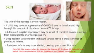 SKIN
The skin of the neonate is often reddish.
A child may have an appearance of CYANOSIS due to thin skin and high
hemoglobin content of blood even when CO2 is high
A deep red purplish appearance may be result of transient anoxia resulting
from closed glottis prior to vigorous cry.
Deep red skin with fine soft immature lanugo hair is a characteristics of
premature infants.
Post-term infants may show whitish, peeling, parchment like skin.
Carlo WA. The newborn infant. In: Kliegman RM, Stanton BF, St. Geme JW, Schor NF, eds.
Nelson Textbook of Pediatrics. 20th ed. Philadelphia, PA: Elsevier; 2016:chap 94.
 