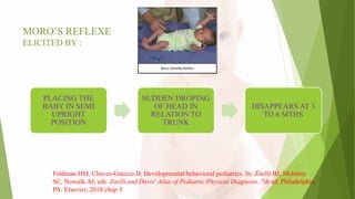 MORO’S REFLEXE
ELICITED BY :
PLACING THE
BABY IN SEMI
UPRIGHT
POSITION
SUDDEN DROPING
OF HEAD IN
RELATION TO
TRUNK
DISAPPEARS AT 3
TO 6 MTHS
Feldman HM, Chaves-Gnecco D. Developmental/behavioral pediatrics. In: Zitelli BJ, McIntire
SC, Nowalk AJ, eds. Zitelli and Davis' Atlas of Pediatric Physical Diagnosis. 7th ed. Philadelphia,
PA: Elsevier; 2018:chap 3
 
