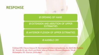 RESPONSE
Ø OPENING OF HAND
Ø EXTENSION AND ABDUTION OF UPPER
EXTRIMITIES
Ø ANTERIOR FLEXION OF UPPER EXTRIMITIES
Ø AUDIBLE CRY
Feldman HM, Chaves-Gnecco D. Developmental/behavioral pediatrics. In: Zitelli BJ, McIntire
SC, Nowalk AJ, eds. Zitelli and Davis' Atlas of Pediatric Physical Diagnosis. 7th ed.
Philadelphia, PA: Elsevier; 2018:chap 3
 