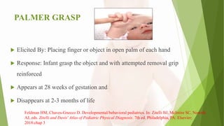 PALMER GRASP
 Elicited By: Placing finger or object in open palm of each hand
 Response: Infant grasp the object and with attempted removal grip
reinforced
 Appears at 28 weeks of gestation and
 Disappears at 2-3 months of life
Feldman HM, Chaves-Gnecco D. Developmental/behavioral pediatrics. In: Zitelli BJ, McIntire SC, Nowalk
AJ, eds. Zitelli and Davis' Atlas of Pediatric Physical Diagnosis. 7th ed. Philadelphia, PA: Elsevier;
2018:chap 3
 