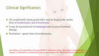 Clinical Significance:
 An exceptionally strong grasp reflex may be found in the spastic
form of cerebral palsy and in kernicterus.
 It may be asymmetrical in hemiplegia and in cases of cerebral
damage
 Persistence - spastic form of cerebral palsy.
Surveillance of Cerebral Palsy in Europe (SCPE) Collaborative Group. Surveillance of cerebral palsy in
Europe: a collaboration of cerebral palsy surveys and registers. Dev Med Child Neurol. 2000;42:816–24
 