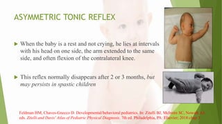 ASYMMETRIC TONIC REFLEX
 When the baby is a rest and not crying, he lies at intervals
with his head on one side, the arm extended to the same
side, and often flexion of the contralateral knee.
 This reflex normally disappears after 2 or 3 months, but
may persists in spastic children
Feldman HM, Chaves-Gnecco D. Developmental/behavioral pediatrics. In: Zitelli BJ, McIntire SC, Nowalk AJ,
eds. Zitelli and Davis' Atlas of Pediatric Physical Diagnosis. 7th ed. Philadelphia, PA: Elsevier; 2018:chap 3
 