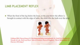LIMB PLACEMENT REFLEX
 When the front of the leg below the knee, or the arm below the elbow is
brought in contact with the edge of table, the child lifts the limb over the edge.
Feldman HM, Chaves-Gnecco D. Developmental/behavioral pediatrics. In: Zitelli BJ, McIntire SC,
Nowalk AJ, eds. Zitelli and Davis' Atlas of Pediatric Physical Diagnosis. 7th ed. Philadelphia, PA:
Elsevier; 2018:chap 3
 