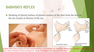 BABINSKI'S REFLEX
 Stroking of lateral surface of planter surface of the foot from the heel to
the toe results in flexion of the toe.
Feldman HM, Chaves-Gnecco D. Developmental/behavioral pediatrics. In: Zitelli BJ, McIntire SC, Nowalk AJ, eds. Zitelli and
Davis' Atlas of Pediatric Physical Diagnosis. 7th ed. Philadelphia, PA: Elsevier; 2018:chap 3
 