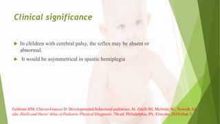 Clinical significance
 In children with cerebral palsy, the reflex may be absent or
abnormal.
 It would be asymmetrical in spastic hemiplegia
Feldman HM, Chaves-Gnecco D. Developmental/behavioral pediatrics. In: Zitelli BJ, McIntire SC, Nowalk AJ,
eds. Zitelli and Davis' Atlas of Pediatric Physical Diagnosis. 7th ed. Philadelphia, PA: Elsevier; 2018:chap 3
 