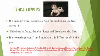 LANDAU REFLEX
 It is seen in vertical suspension, with the head, spine and legs
extended.
 If the head is flexed, the hips , knees and the elbows also flex.
 It is normally present from 3 months and is difficult to elicit after 1
year.
Rennie JM, Huertas-Ceballos A, Boylan GB, et al. Neurological problems in the newborn. In: Rennie
JM, ed. Rennie and Roberton's Textbook of Neonatology. 5th ed. Philadelphia, PA: Elsevier Churchill
Livingstone; 2012:chap 40.
 