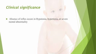 Clinical significance
 Absence of reflex occurs in Hypotonia, hypertonia, or severe
mental abnormality
 